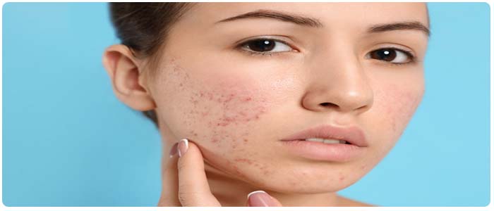 Dermascar